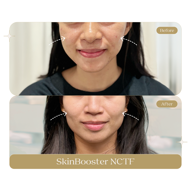 SKIN-BOOSTER-NCTF